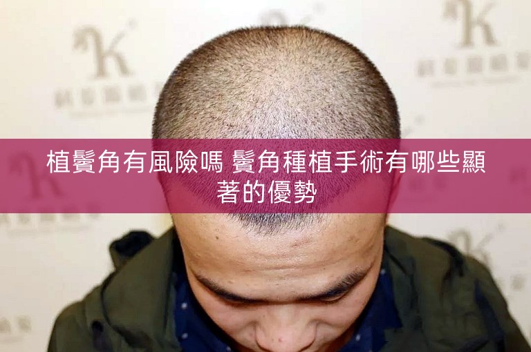 植鬢角有風險嗎 鬢角種植手術有哪些顯著的優勢