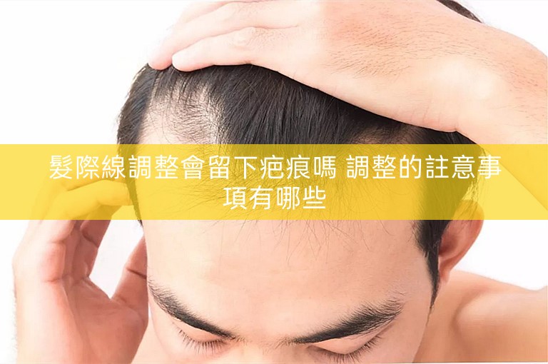 髮際線調整會留下疤痕嗎 調整的註意事項有哪些