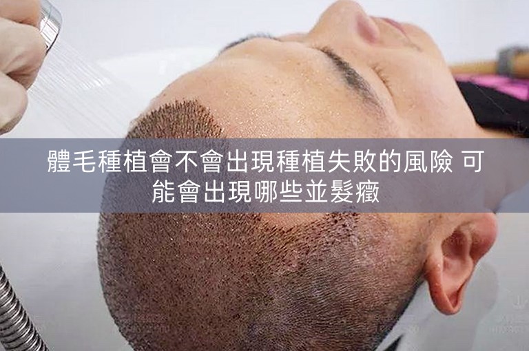 體毛種植會不會出現種植失敗的風險 可能會出現哪些並髮癥