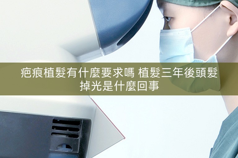 疤痕植髮有什麼要求嗎 植髮三年後頭髮掉光是什麼回事