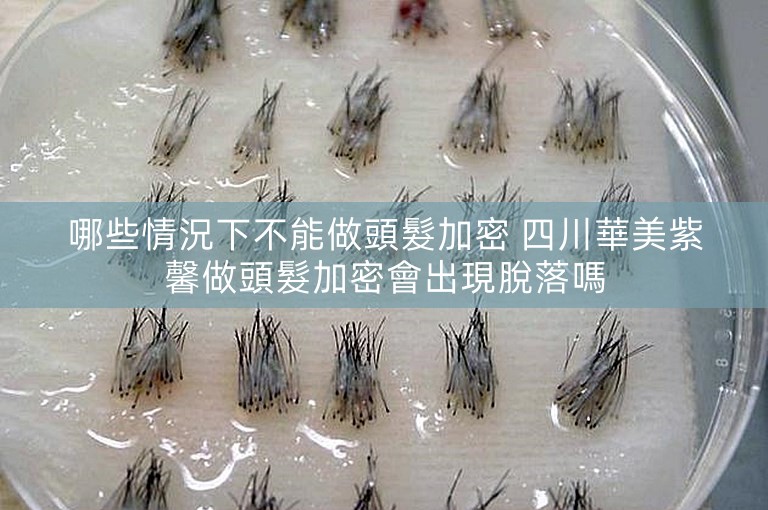 哪些情況下不能做頭髮加密 四川華美紫馨做頭髮加密會出現脫落嗎