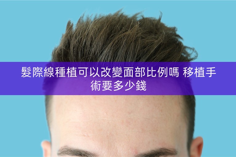髮際線種植可以改變面部比例嗎 移植手術要多少錢