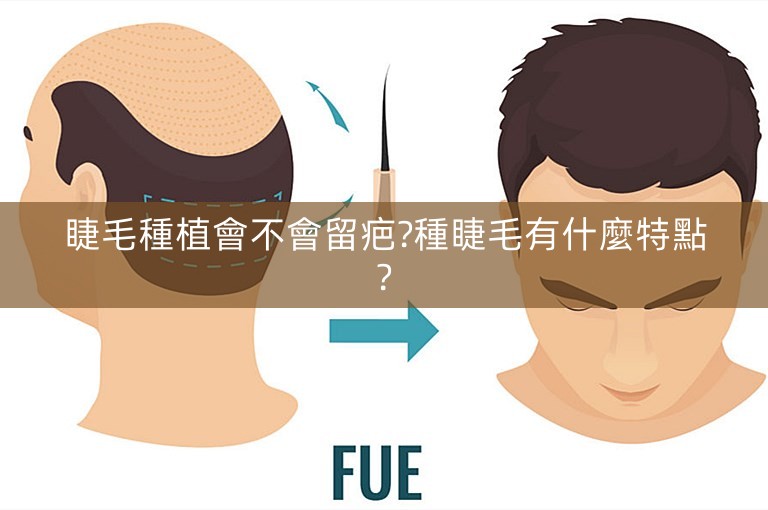 睫毛種植會不會留疤?種睫毛有什麼特點?