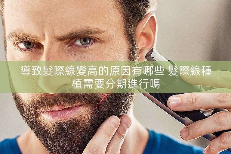 導致髮際線變高的原因有哪些 髮際線種植需要分期進行嗎