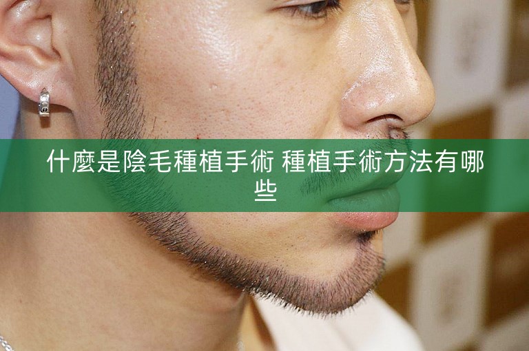 什麼是陰毛種植手術 種植手術方法有哪些
