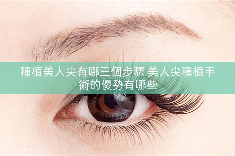 種植美人尖有哪三個步驟 美人尖種植手術的優勢有哪些