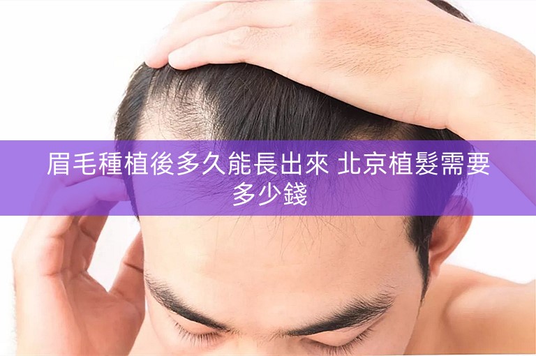 眉毛種植後多久能長出來 北京植髮需要多少錢