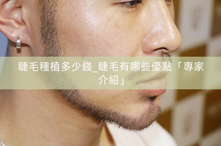 睫毛種植多少錢_睫毛有哪些優點「專家介紹」 睫毛種植多少錢_睫毛有哪些優點「專家介紹」