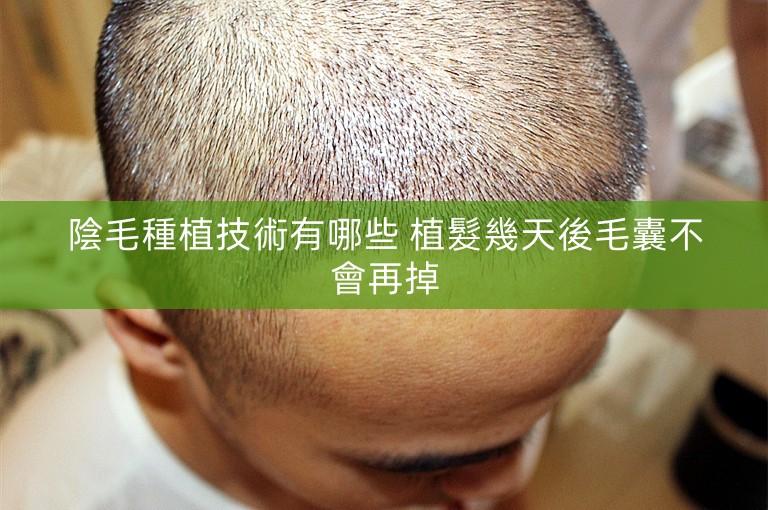 陰毛種植技術有哪些 植髮幾天後毛囊不會再掉