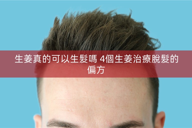 生姜真的可以生髮嗎 4個生姜治療脫髮的偏方