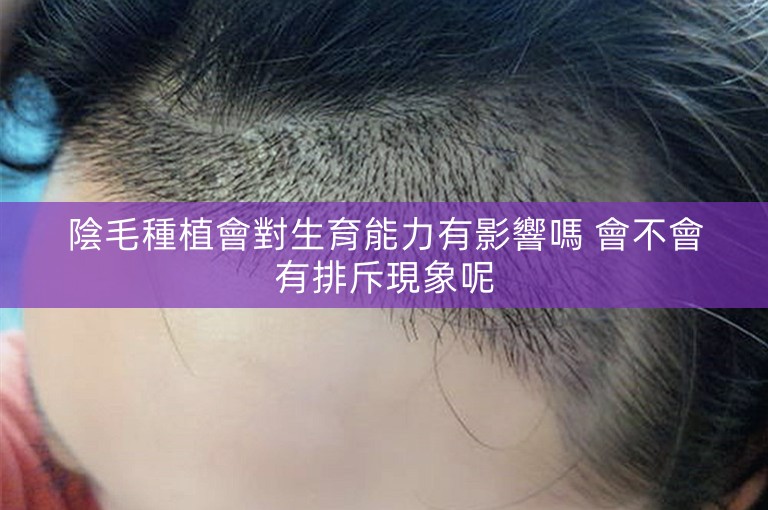 陰毛種植會對生育能力有影響嗎 會不會有排斥現象呢