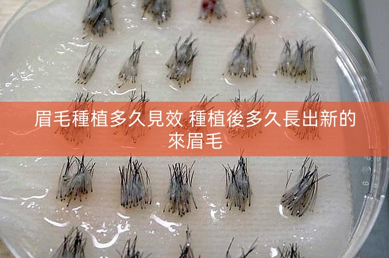 眉毛種植多久見效 種植後多久長出新的來眉毛