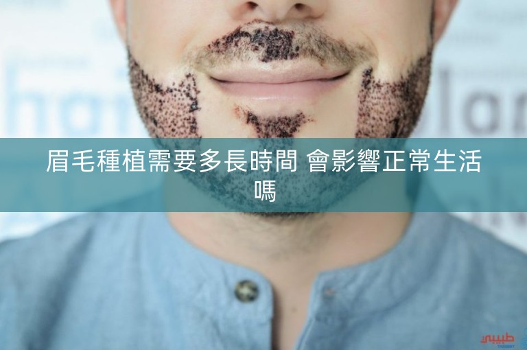 眉毛種植需要多長時間 會影響正常生活嗎