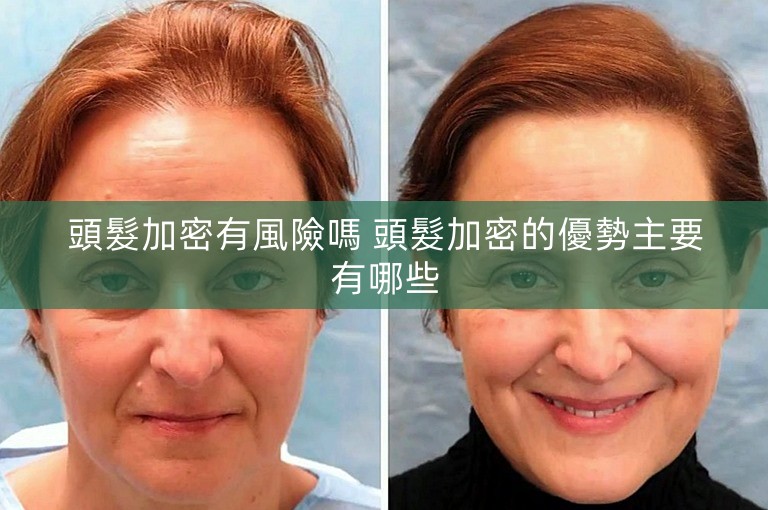 頭髮加密有風險嗎 頭髮加密的優勢主要有哪些