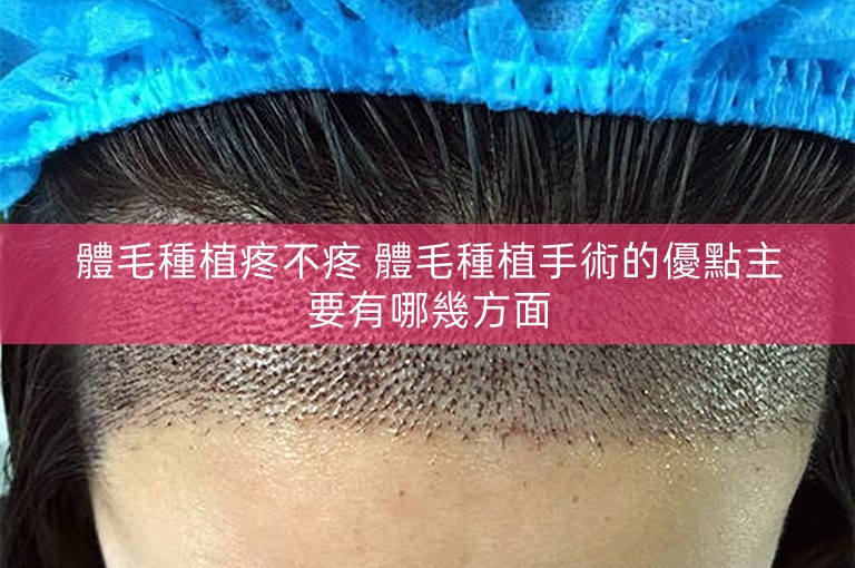 體毛種植疼不疼 體毛種植手術的優點主要有哪幾方面 體毛種植疼不疼 體毛種植手術的優點主要有哪幾方面