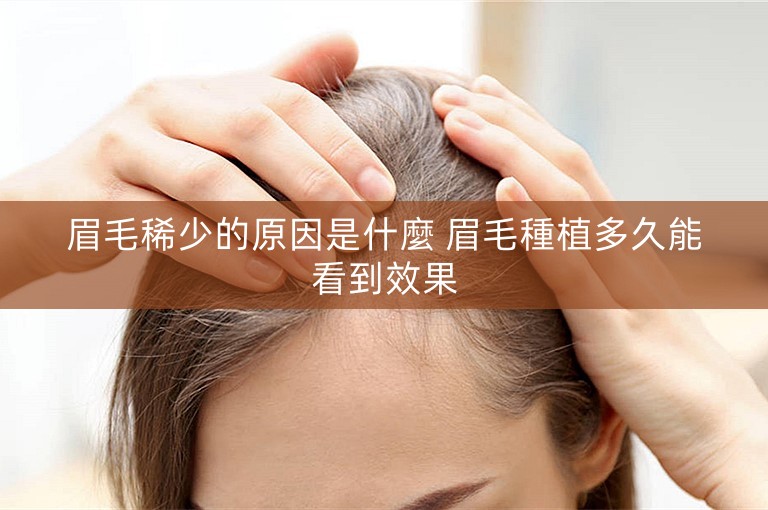 眉毛稀少的原因是什麼 眉毛種植多久能看到效果