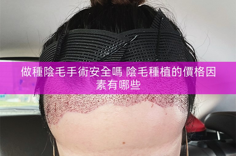 做種陰毛手術安全嗎 陰毛種植的價格因素有哪些 做種陰毛手術安全嗎 陰毛種植的價格因素有哪些