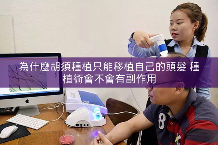 為什麼胡須種植只能移植自己的頭髮 種植術會不會有副作用