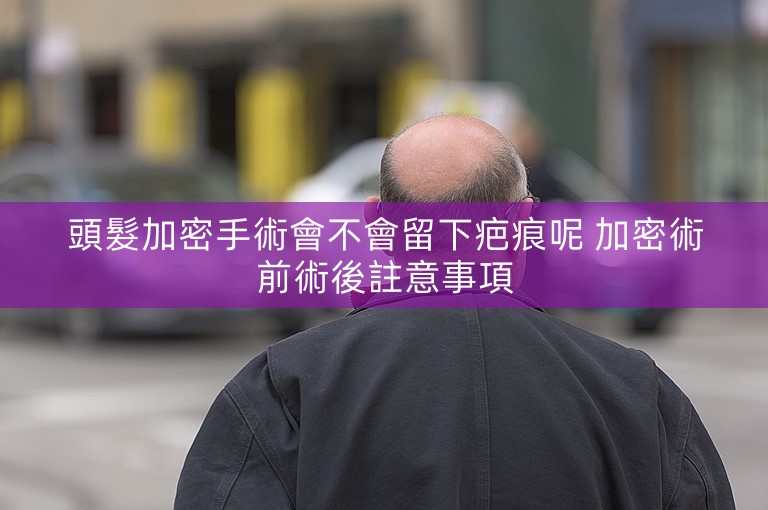 頭髮加密手術會不會留下疤痕呢 加密術前術後註意事項