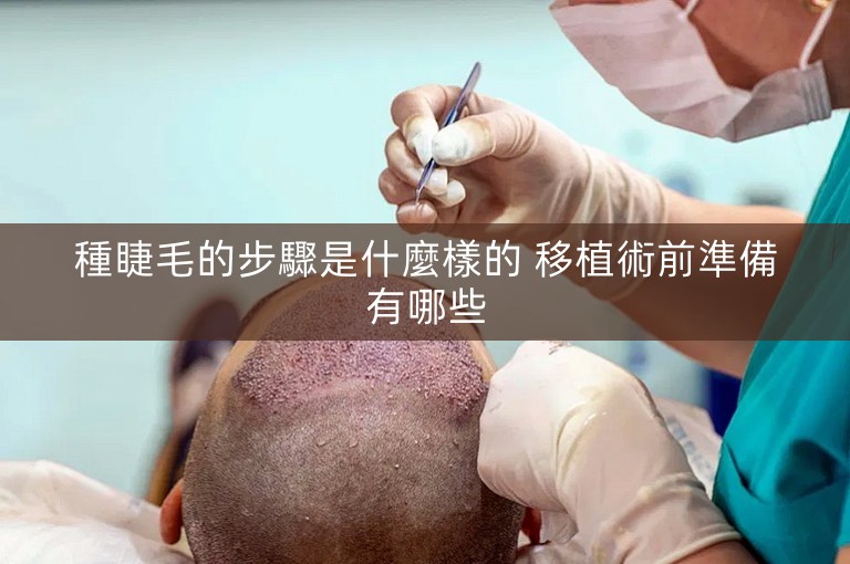 種睫毛的步驟是什麼樣的 移植術前準備有哪些