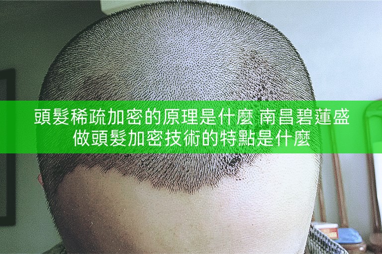 頭髮稀疏加密的原理是什麼 南昌碧蓮盛做頭髮加密技術的特點是什麼