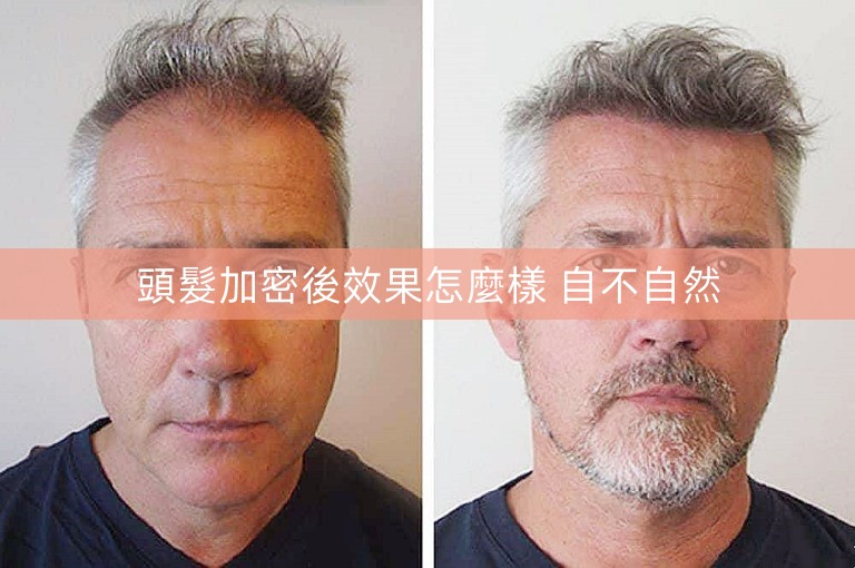頭髮加密後效果怎麼樣 自不自然 頭髮加密後效果怎麼樣 自不自然