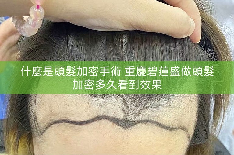 什麼是頭髮加密手術 重慶碧蓮盛做頭髮加密多久看到效果