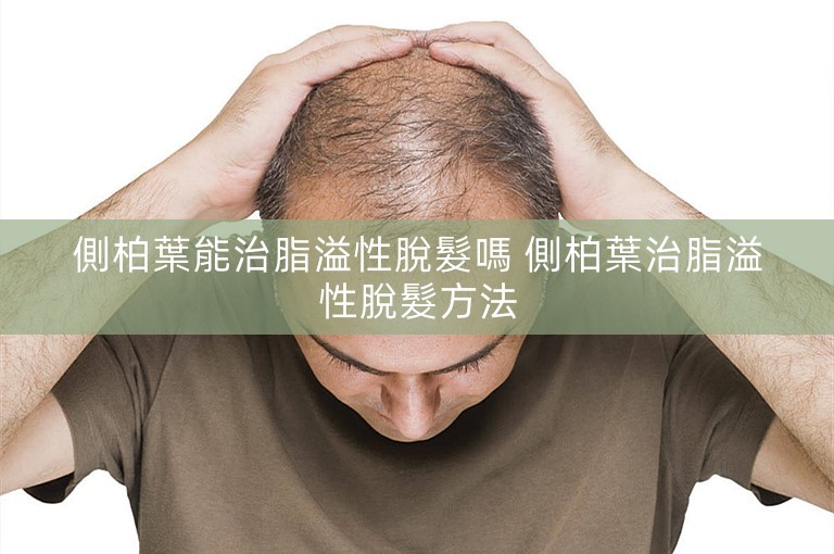 側柏葉能治脂溢性脫髮嗎 側柏葉治脂溢性脫髮方法