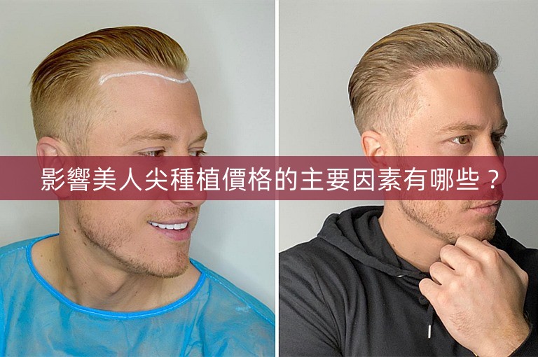 影響美人尖種植價格的主要因素有哪些？