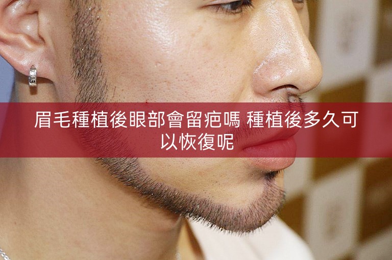 眉毛種植後眼部會留疤嗎 種植後多久可以恢復呢
