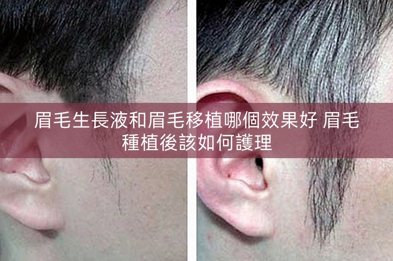 眉毛生長液和眉毛移植哪個效果好 眉毛種植後該如何護理