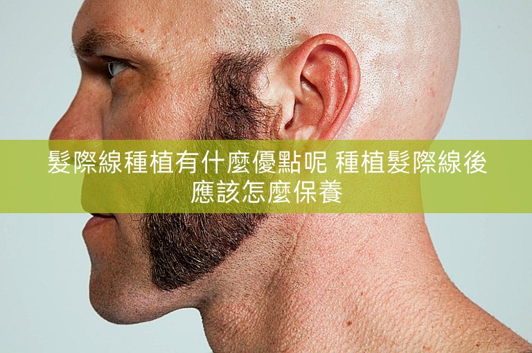 髮際線種植有什麼優點呢 種植髮際線後應該怎麼保養