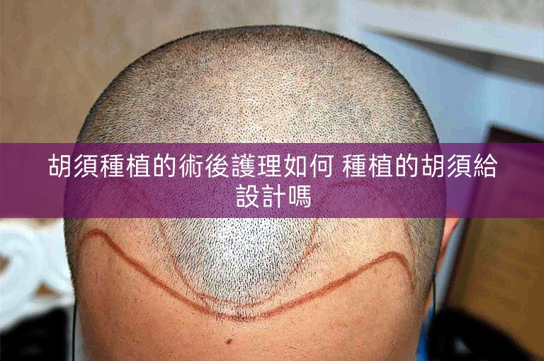 胡須種植的術後護理如何 種植的胡須給設計嗎 胡須種植的術後護理如何 種植的胡須給設計嗎