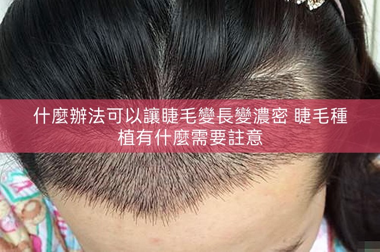 什麼辦法可以讓睫毛變長變濃密 睫毛種植有什麼需要註意