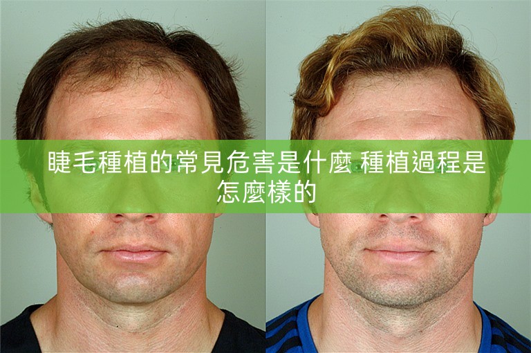 睫毛種植的常見危害是什麼 種植過程是怎麼樣的