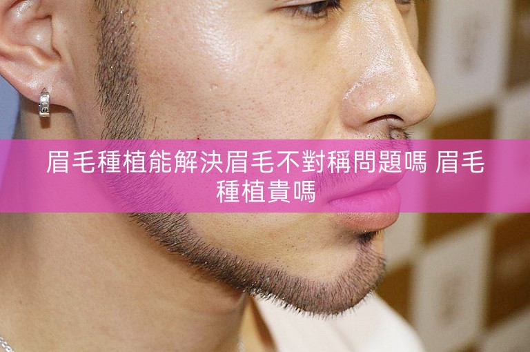 眉毛種植能解決眉毛不對稱問題嗎 眉毛種植貴嗎