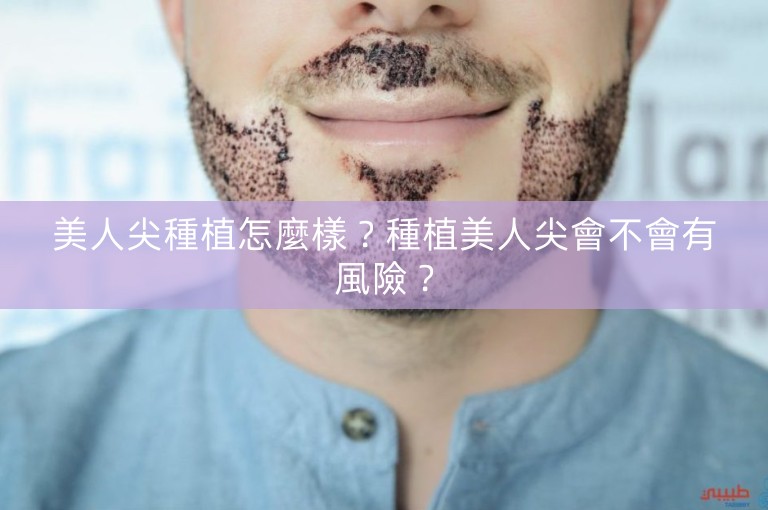 美人尖種植怎麼樣？種植美人尖會不會有風險？