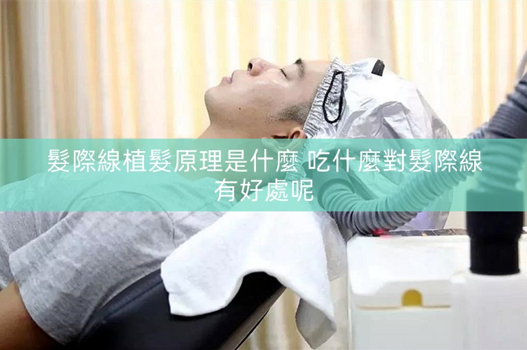 髮際線植髮原理是什麼 吃什麼對髮際線有好處呢 髮際線植髮原理是什麼 吃什麼對髮際線有好處呢