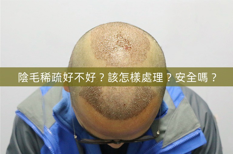 陰毛稀疏好不好?該怎樣處理?安全嗎? 陰毛稀疏好不好?該怎樣處理?安全嗎?