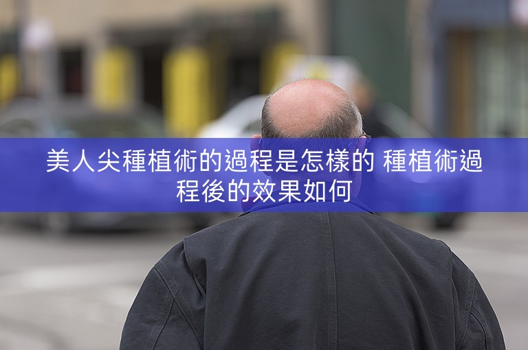 美人尖種植術的過程是怎樣的 種植術過程後的效果如何