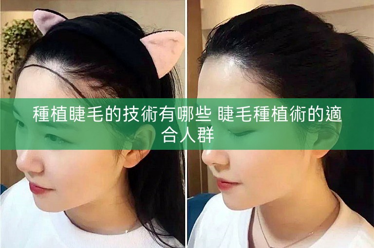 種植睫毛的技術有哪些 睫毛種植術的適合人群