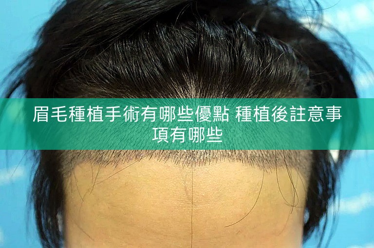 眉毛種植手術有哪些優點 種植後註意事項有哪些
