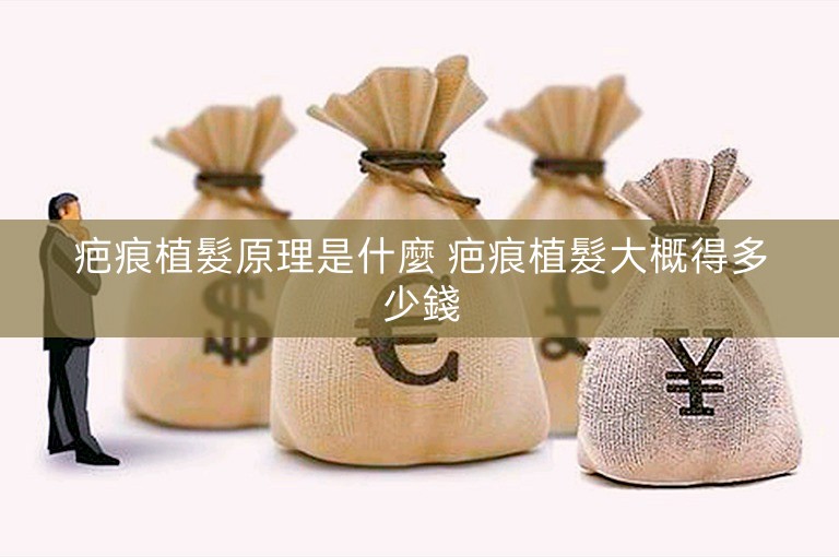 疤痕植髮原理是什麼 疤痕植髮大概得多少錢