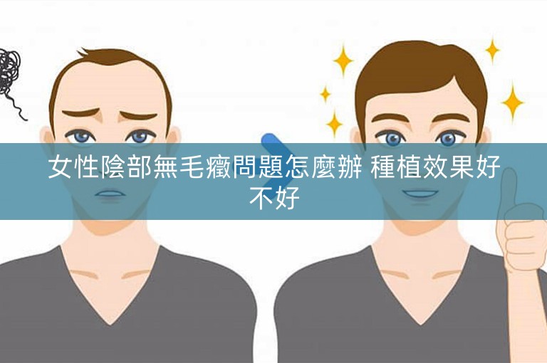 女性陰部無毛癥問題怎麼辦 種植效果好不好 女性陰部無毛癥問題怎麼辦 種植效果好不好