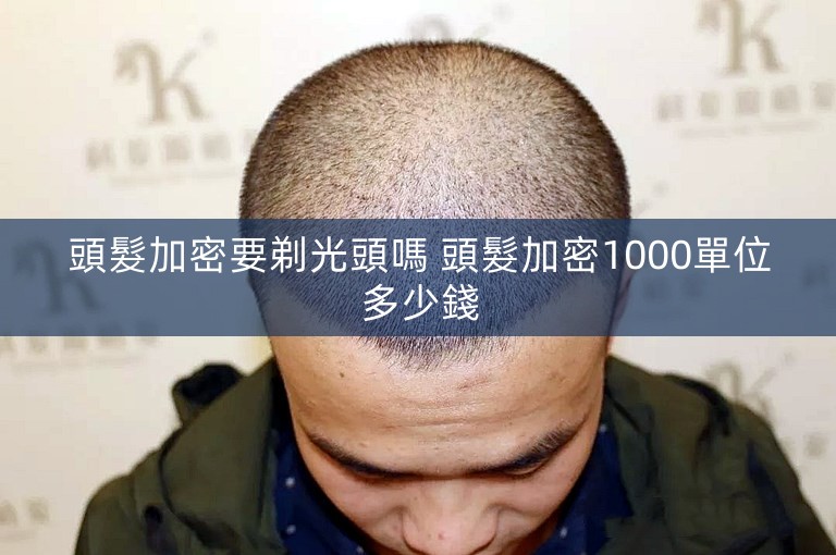 頭髮加密要剃光頭嗎 頭髮加密1000單位多少錢
