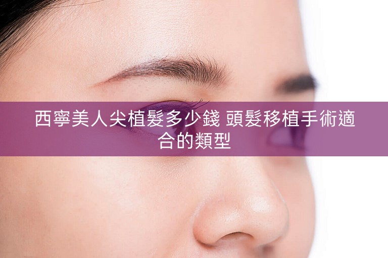 西寧美人尖植髮多少錢 頭髮移植手術適合的類型
