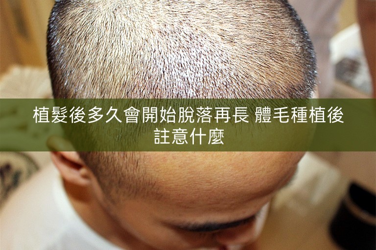 植髮後多久會開始脫落再長 體毛種植後註意什麼