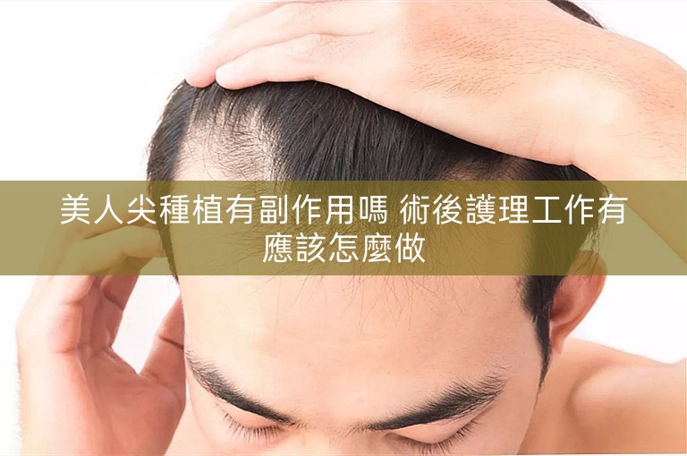 美人尖種植有副作用嗎 術後護理工作有應該怎麼做