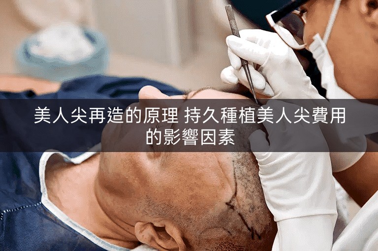 美人尖再造的原理 持久種植美人尖費用的影響因素