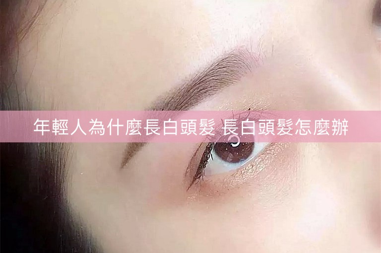 年輕人為什麼長白頭髮 長白頭髮怎麼辦